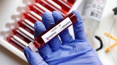 Еще девять новосибирцев с COVID-19 умерли за минувшие сутки - runews24.ru - Новосибирская обл.