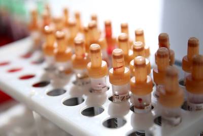 Ученые обнаружили антибиотик, способный вылечить рак кожи - vm.ru - Бельгия