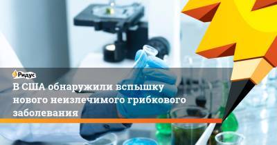 В США обнаружили вспышку нового неизлечимого грибкового заболевания - ridus.ru - США - Вашингтон - Техас