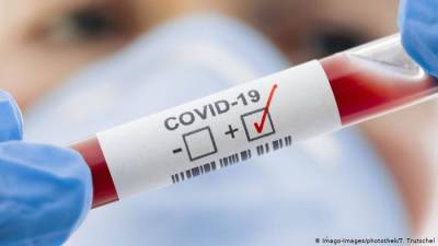 Девять новосибирцев с подтвержденным COVID-19 умерли за минувшие сутки - runews24.ru - Новосибирская обл.