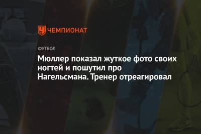 Томас Мюллер - Юлиан Нагельсман - Мюллер показал жуткое фото своих ногтей и пошутил про Нагельсмана. Тренер отреагировал - championat.com