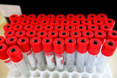В ВОЗ заявили, что смертность от коронавируса выросла за неделю в мире более чем на 20% - argumenti.ru - Рима