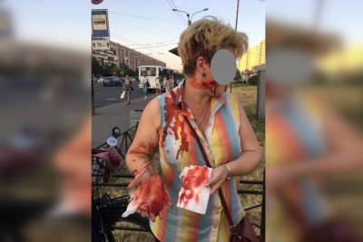 Агрессивная мать проломила петербурженке голову самокатом - spb.mk.ru - р-н. Московский