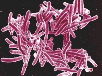 Выявлен ген, с помощью которого возбудитель туберкулеза снижает иммунитет человека - polit.ru - шт. Мэриленд