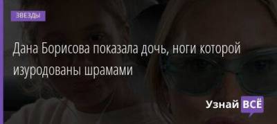 Дана Борисова - Дана Борисова показала дочь, ноги которой изуродованы шрамами - skuke.net - Англия