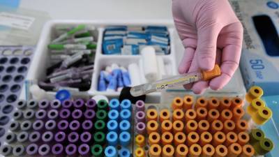 Алексей Аграновский - Как остановить мутацию COVID-19 – инфекционист - crimea.ria.ru - Крым - Симферополь
