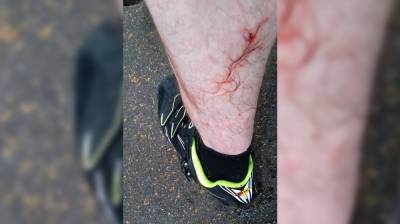 Собака с чипом напала на воронежского велосипедиста в «Олимпике» - vestivrn.ru - Воронеж