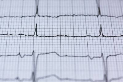 Express Health: скачки пульса могут говорить о дефиците витамина В12 - mk.ru