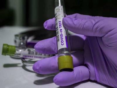 С начала эпидемии коронавируса более одиннадцати миллионов украинцев сдали ПЦР-тесты - lenta.ua - Украина - Киев - Токио