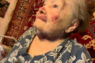 Александр Шульга - В Екатеринбурге возбудили уголовное дело после избиения 95-летней пенсионерки - znak.com - Россия - Екатеринбург - Свердловская обл. - район Кировский, Екатеринбург