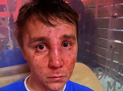 Липчанина жестоко избили ночью в баре - 7info.ru - Липецк - Бар
