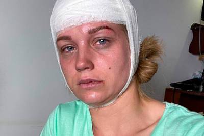 Кристина Асмус - Кристина Асмус обеспокоила поклонников фотографией с изувеченным лицом - lenta.ru - Россия
