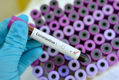 В Курской области за минувшие сутки выявлено 192 факта заражения COVID-19 - chr.mk.ru - Курская обл.