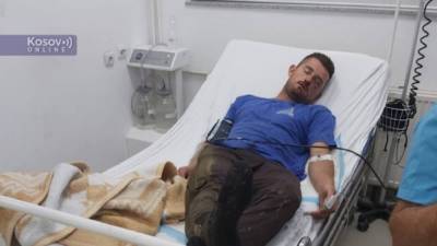 Молодой сербский пастух был сильно избит албанцами в Косово - politnavigator.net - Сербия - Косово