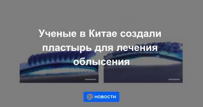 Ученые в Китае создали пластырь для лечения облысения - news.mail.ru - Китай