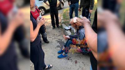 В Воронеже на женщину напала стая собак - vestivrn.ru - Воронеж