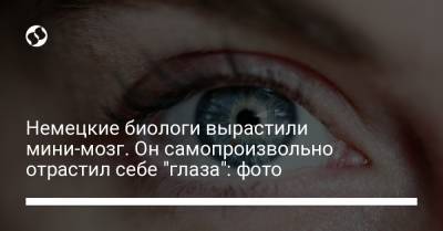 Немецкие биологи вырастили мини-мозг. Он самопроизвольно отрастил себе "глаза": фото - liga.net - Украина
