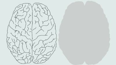 Немецкие ученые вырастили в лаборатории мини-мозг с глазами - mir24.tv - Германия - Дюссельдорф