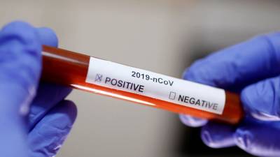 Роджер Уикер - Три вакцинировавшихся сенатора США заразились коронавирусом - trend.az - США - шт. Колорадо - штат Миссисипи - штат Мэн