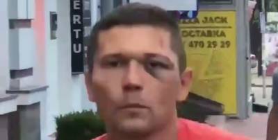 Надежда Дорофеева - ГБР задержало военного из УДО, который избил танцора из балета Дорофеевой (видео) - sharij.net - Украина - Киев