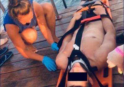 В Челябинске несколько человек получили травмы позвоночника, прыгая с понтона - znak.com - Челябинск