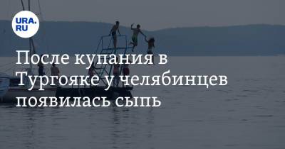После купания в Тургояке у челябинцев появилась сыпь. Фото - ura.news - Челябинская обл. - Магнитогорск - Экология