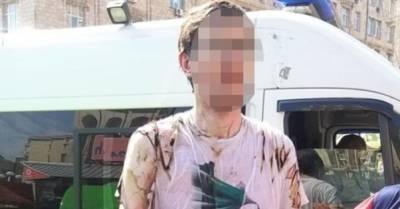 Мужчина поджег себя во время парада ко Дню Независимости в Киеве (ФОТО, ВИДЕО) - delo.ua - Украина - Киев