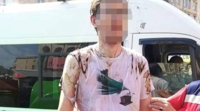 В центре Киева во время парада мужчина пытался себя сжечь - ru.slovoidilo.ua - Украина - Киев