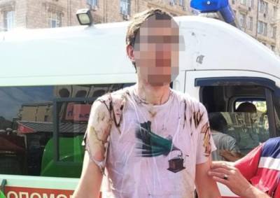 Мужчина поджег себя во время парада в центре Киева - vchaspik.ua - Украина - Киев