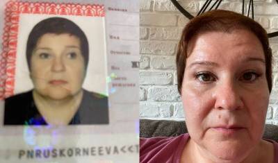 От сложного косоглазия избавили пациентку тюменские врачи - nashgorod.ru