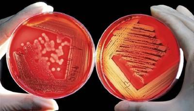 В ЮАР нашли новый штамм коронавируса - mirnov.ru - Китай - Англия - Новая Зеландия - Юар - Конго