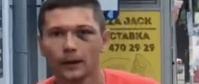 Сотрудника УГО уволили после избиения танцора из шоу-балета Дорофеевой - w-n.com.ua - Украина