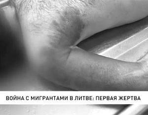 Александр Лукашенко - Белорусский телеканал показал тело погибшего на литовской границе иракца - newsland.com - Белоруссия - Ирак - Литва