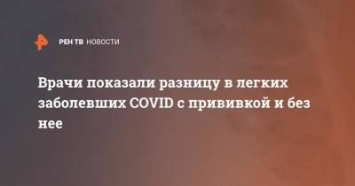 Врачи показали разницу в легких заболевших COVID с прививкой и без нее - ren.tv - штат Миссури