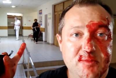 Выдвинувшегося в красноярский парламент журналиста избили в избиркоме - tayga.info - Россия - Красноярск