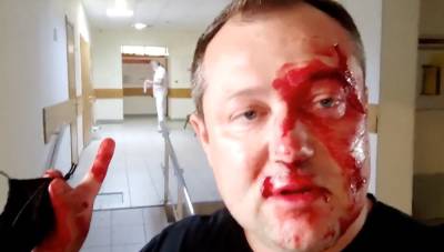 В красноярском избиркоме глава Союза десантников региона избил кандидата в депутаты - znak.com - Россия - Красноярск