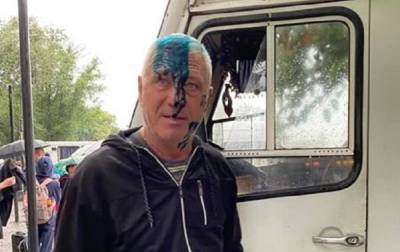 В Одесской области водитель автобуса отказал боевикам «АТО» в бесплатном проезде и попал под удар - anna-news.info - Украина - Одесская обл. - Черноморск