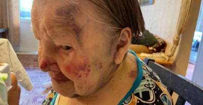 "У неё болит всё": В Екатеринбурге сиделку обвинили в жестоком избиении 95-летней бабушки - reendex.ru - Екатеринбург