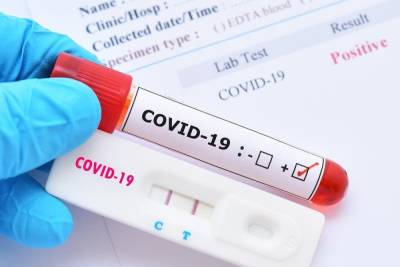 Йенс Шпан - Германия: Бесплатные тесты на COVID-19 хотят отменить - mknews.de - Германия
