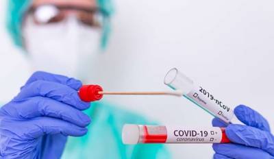 В Украине резко сократился прирост новых случаев COVID-19 - lenta.ua - Украина - Киев - Луганская обл.