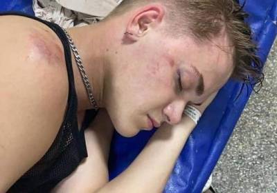 Надежда Дорофеева - Дорофеева рассказала о состоянии своего танцора, избитого сотрудником УГО - kp.ua - Украина - Киев