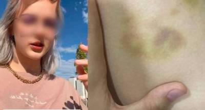 Школьница из Железногорска обвинила отца второго ребёнка в побоях, и теперь его разыскивает полиция - reendex.ru - Самарская обл. - Железногорск