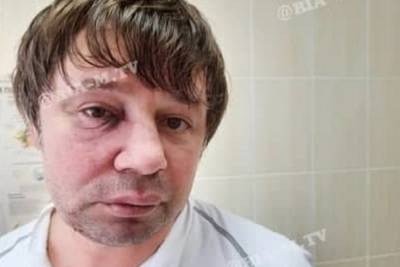 "Ты что, не адекватный?": отец избил врача на глазах у ребенка, видео - politeka.net - Украина - Мелитополь
