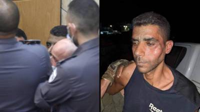 Збейди пожаловался на избиение со стороны охранников, его везут в "Рамбам" - vesty.co.il - Израиль