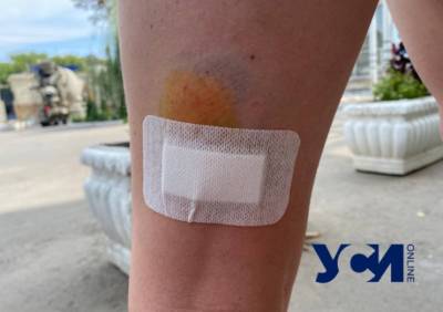 В Одессе собаки искусали молодую мать – та едва спасла своего ребенка - odessa-life.od.ua - Украина - Одесса - Нападение