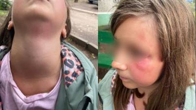 Разбойник оказался педофилом: нападение на 9-летнюю школьницу в Солнечногорске - eadaily.com - Солнечногорск