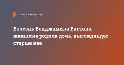 Бенджамин Баттон - Болезнь Бенджамина Баттона: женщина родила дочь, выглядящую старше нее - ren.tv - Юар