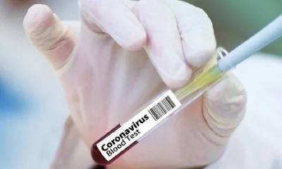 Зараженных коронавирусом выявили в 16 муниципалитетах Смоленской области - rabochy-put.ru - Смоленск - Смоленская обл. - район Духовщинский
