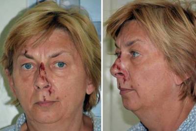 Женщина потеряла память и несколько дней провела на кишащем медведями острове - lenta.ru - Хорватия