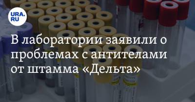 В лаборатории заявили о проблемах с антителами от штамма «Дельта» - ura.news